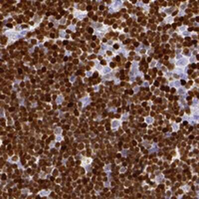 Immunohistochemistry-Paraffin: SATB1 Antibody [NBP2-54994]