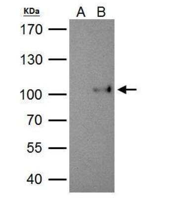 Immunoprecipitation: SATB1 Antibody [NBP2-15107]