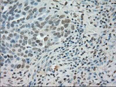 Immunohistochemistry: SATB1 Antibody (OTI13D6) - Azide and BSA Free [NBP2-73991]