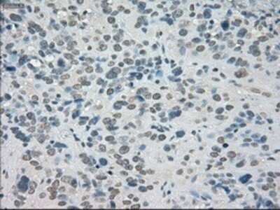 Immunohistochemistry: SATB1 Antibody (OTI13D6) - Azide and BSA Free [NBP2-73991]