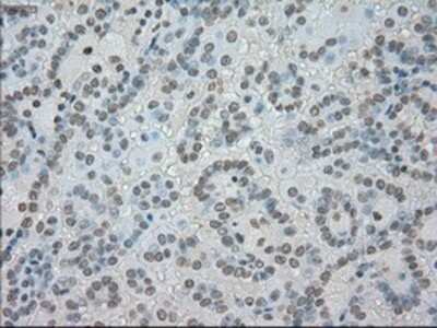Immunohistochemistry: SATB1 Antibody (OTI13D6) - Azide and BSA Free [NBP2-73991]