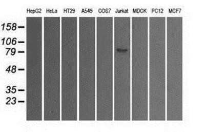 Western Blot: SATB1 Antibody (OTI13D6)Azide and BSA Free [NBP2-73991]