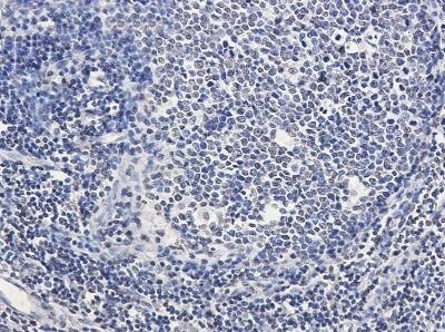 Immunohistochemistry-Paraffin: SATB1 Antibody (S03-5H7) [NBP3-19810]