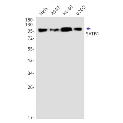 Western Blot: SATB1 Antibody (S03-5H7) [NBP3-19810]