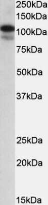 Western Blot: SATB1 Antibody [NBP1-51960]