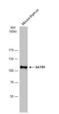 Western Blot: SATB1 Antibody [NBP2-15107]