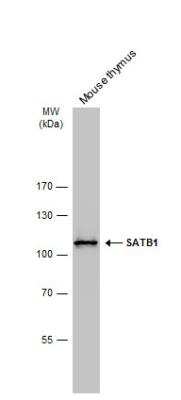 Western Blot: SATB1 Antibody [NBP2-15108]