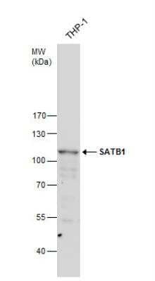 Western Blot: SATB1 Antibody [NBP2-15108]