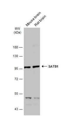 Western Blot: SATB1 Antibody [NBP2-15108]