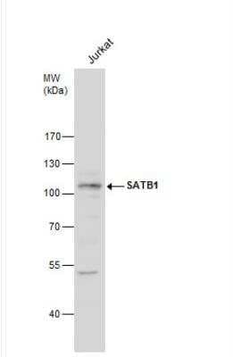 Western Blot: SATB1 Antibody [NBP2-15108]