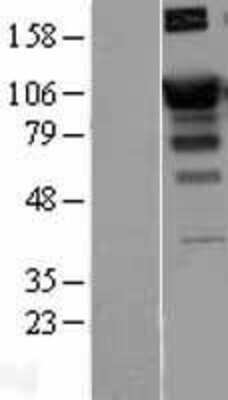 Western Blot: SATB1 Overexpression Lysate [NBL1-15700]