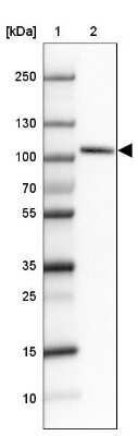 Western Blot: SATB2 Antibody (CL0323) [NBP2-52916]