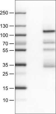 Western Blot: SATB2 Antibody (CL0323) [NBP2-52916]