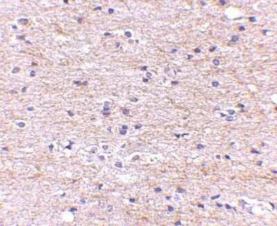Immunohistochemistry-Paraffin: SATB2 Antibody - BSA Free [NBP1-76912]
