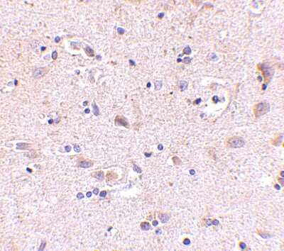 Immunohistochemistry-Paraffin: SATB2 Antibody - BSA Free [NBP1-76913]