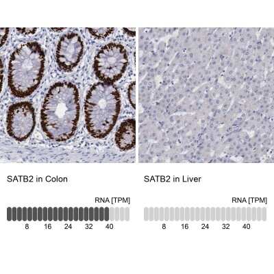 Immunohistochemistry-Paraffin: SATB2 Antibody [NBP1-83619]