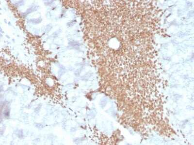 Immunohistochemistry-Paraffin: SATB2 Antibody (SATB2/4374R) - Azide and BSA Free [NBP3-08808]