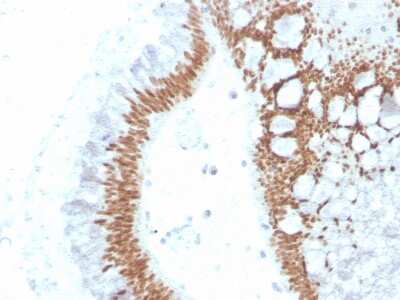 Immunohistochemistry-Paraffin: SATB2 Antibody (SATB2/4374R) - Azide and BSA Free [NBP3-08808]