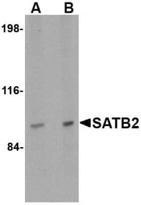 Western Blot: SATB2 AntibodyBSA Free [NBP1-76912]