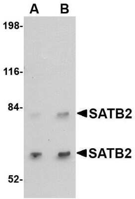 Western Blot: SATB2 AntibodyBSA Free [NBP1-76913]