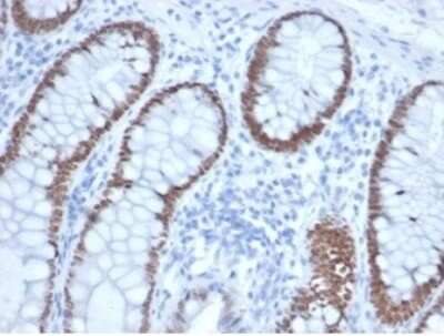 Immunohistochemistry-Paraffin: SATB2 Antibody (rSATB2/6929) [NBP3-13915]