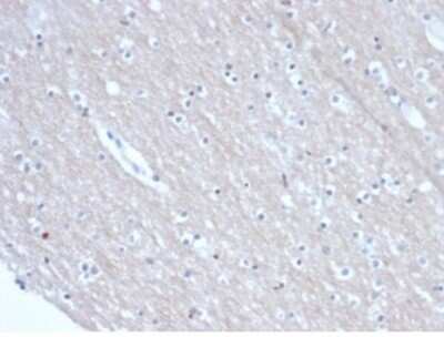 Immunohistochemistry-Paraffin: SATB2 Antibody (rSATB2/6929) [NBP3-13915]