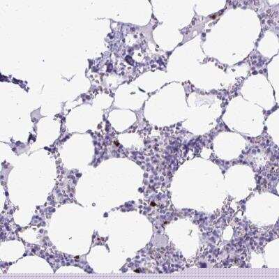 Immunohistochemistry-Paraffin: SATL1 Antibody [NBP2-32537]