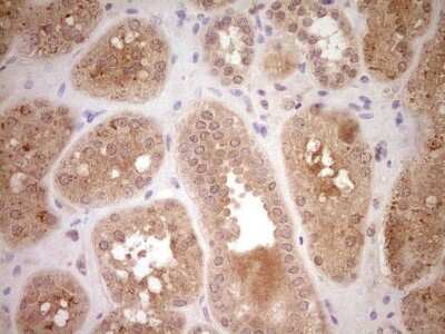Immunohistochemistry: SAV1 Antibody (OTI2B7) [NBP2-45687]