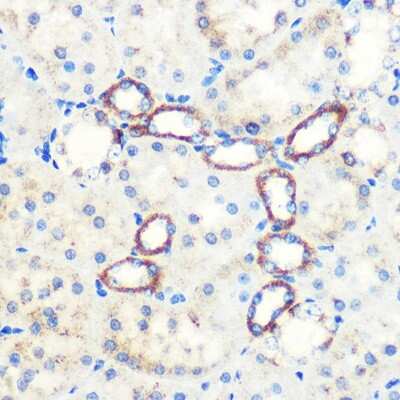 Immunohistochemistry-Paraffin: SAV1 Antibody - Azide and BSA Free [NBP3-15584]