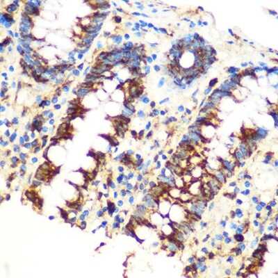 Immunohistochemistry-Paraffin: SAV1 Antibody - Azide and BSA Free [NBP3-15584]