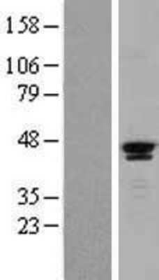 Western Blot: SAV1 Overexpression Lysate [NBL1-15703]