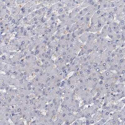 Immunohistochemistry-Paraffin: SBEM Antibody [NBP1-92366]