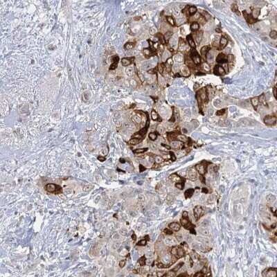 Immunohistochemistry-Paraffin: SBEM Antibody [NBP1-92366]