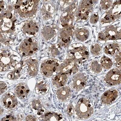 Immunohistochemistry-Paraffin: SBEM Antibody [NBP1-92366]