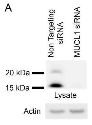 Western Blot: SBEM Antibody [NBP1-92366]