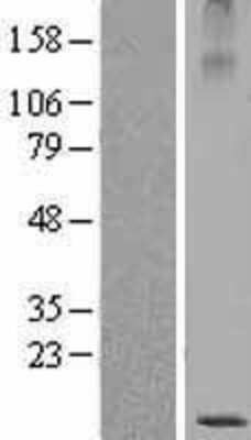 Western Blot: SBEM Overexpression Lysate [NBL1-13393]