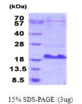 SDS-PAGE: Recombinant Human SBEM His Protein [NBP2-51889]