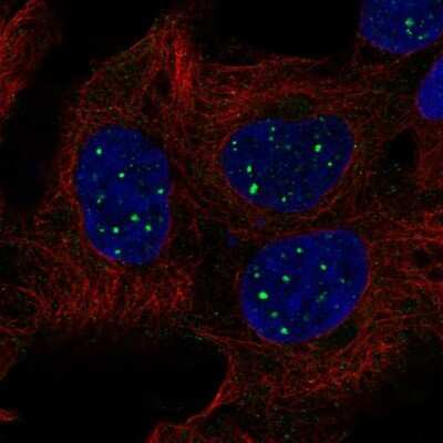 Immunocytochemistry/ Immunofluorescence: SBF1 Antibody [NBP2-68976]