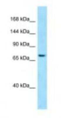 Western Blot: SBF1 Antibody [NBP1-98522]