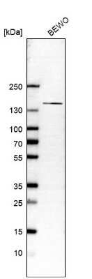 Western Blot: SBF2 Antibody [NBP2-13283]