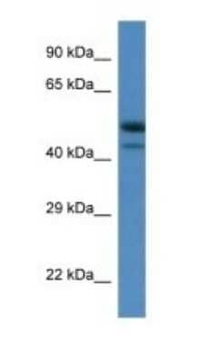 Western Blot: SBK1 Antibody [NBP1-74148]