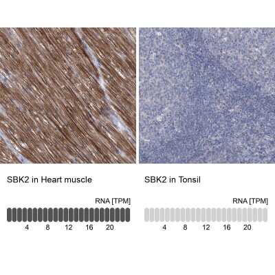 Immunohistochemistry-Paraffin: SBK2 Antibody [NBP1-91020]