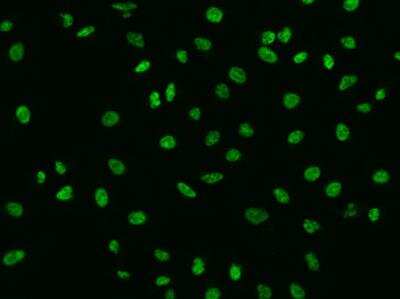 Immunocytochemistry/ Immunofluorescence: SBNO1 Antibody [NBP3-05794]