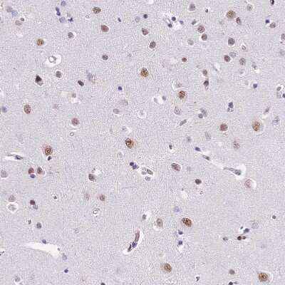 Immunohistochemistry-Paraffin: SBNO1 Antibody [NBP1-83837]