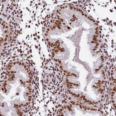 Immunohistochemistry-Paraffin: SBNO1 Antibody [NBP1-83837]