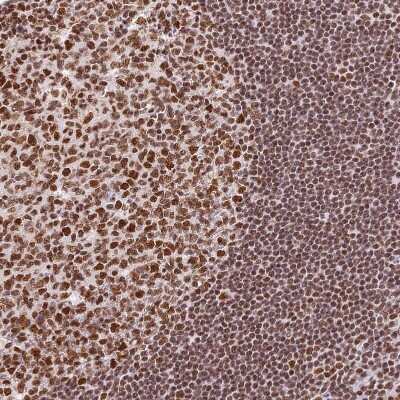 Immunohistochemistry-Paraffin: SBNO1 Antibody [NBP1-83837]
