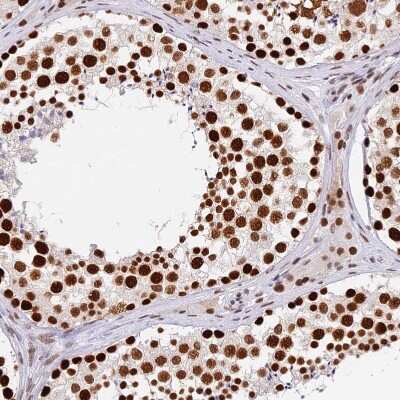 Immunohistochemistry-Paraffin: SBNO1 Antibody [NBP1-83837]