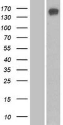 Western Blot: SBNO1 Overexpression Lysate [NBP2-06852]