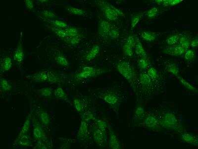 Immunocytochemistry/ Immunofluorescence: SBNO2 Antibody [NBP3-06312]