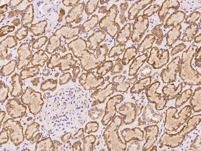 Immunohistochemistry-Paraffin: SBNO2 Antibody [NBP3-06312]